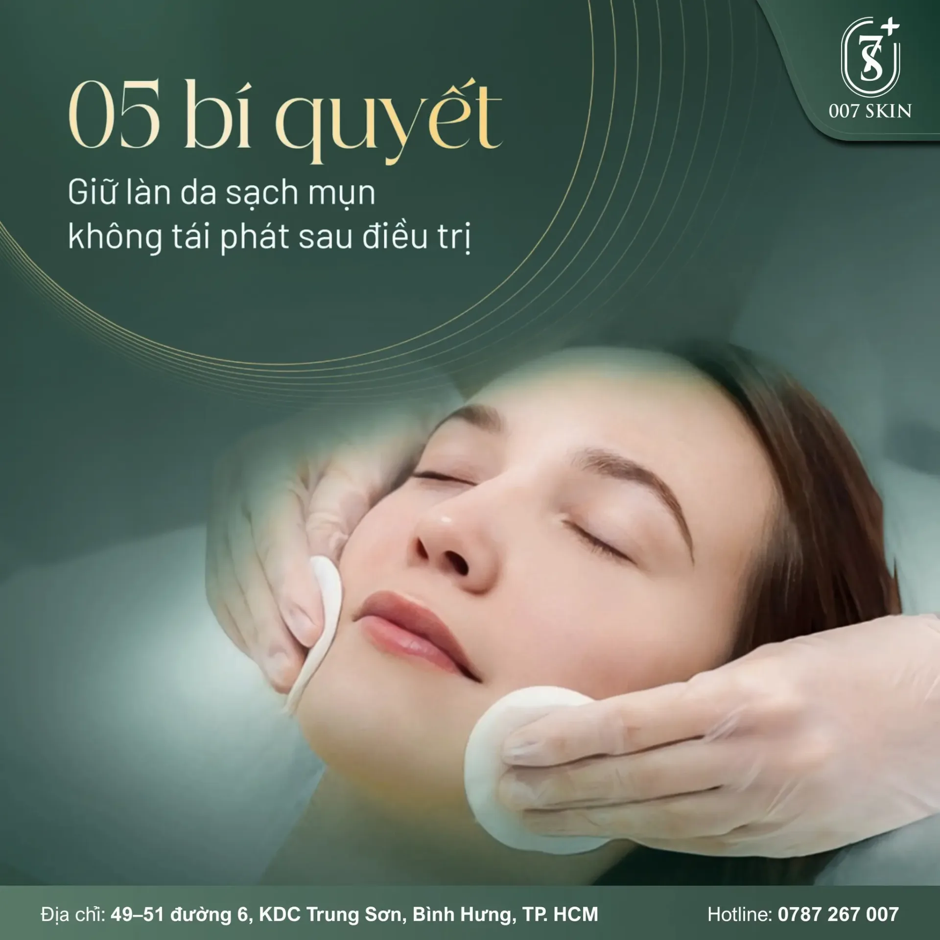 05 BÍ QUYẾT GIỮ LÀN DA SẠCH MỤN – KHÔNG TÁI PHÁT SAU ĐIỀU TRỊ