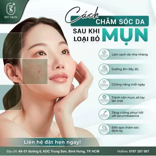 6 BƯỚC VÀNG CHĂM SÓC DA SAU KHI HẾT MỤN 🌟
