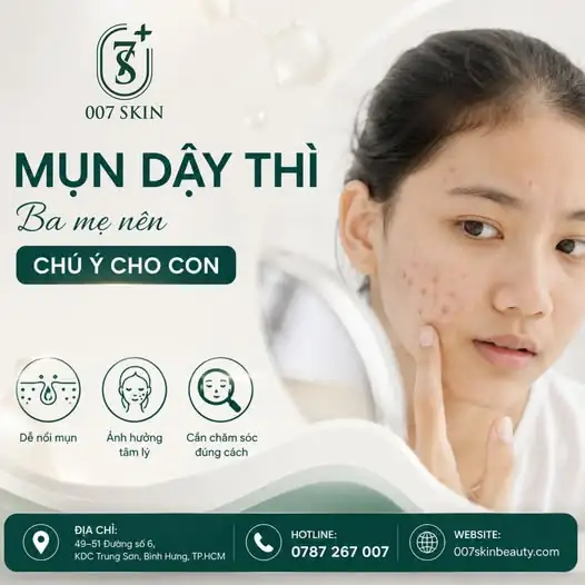 BA MẸ ƠI, ĐỪNG CHỦ QUAN VỚI MỤN TUỔI DẬY THÌ CỦA CON!