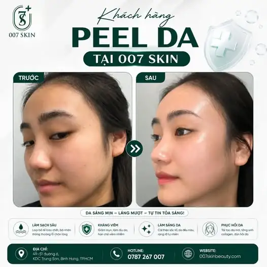 BÍ QUYẾT TÁI TẠO LÀN DA KHÔNG KHUYẾT ĐIỂM TẠI 007 SKIN 💚