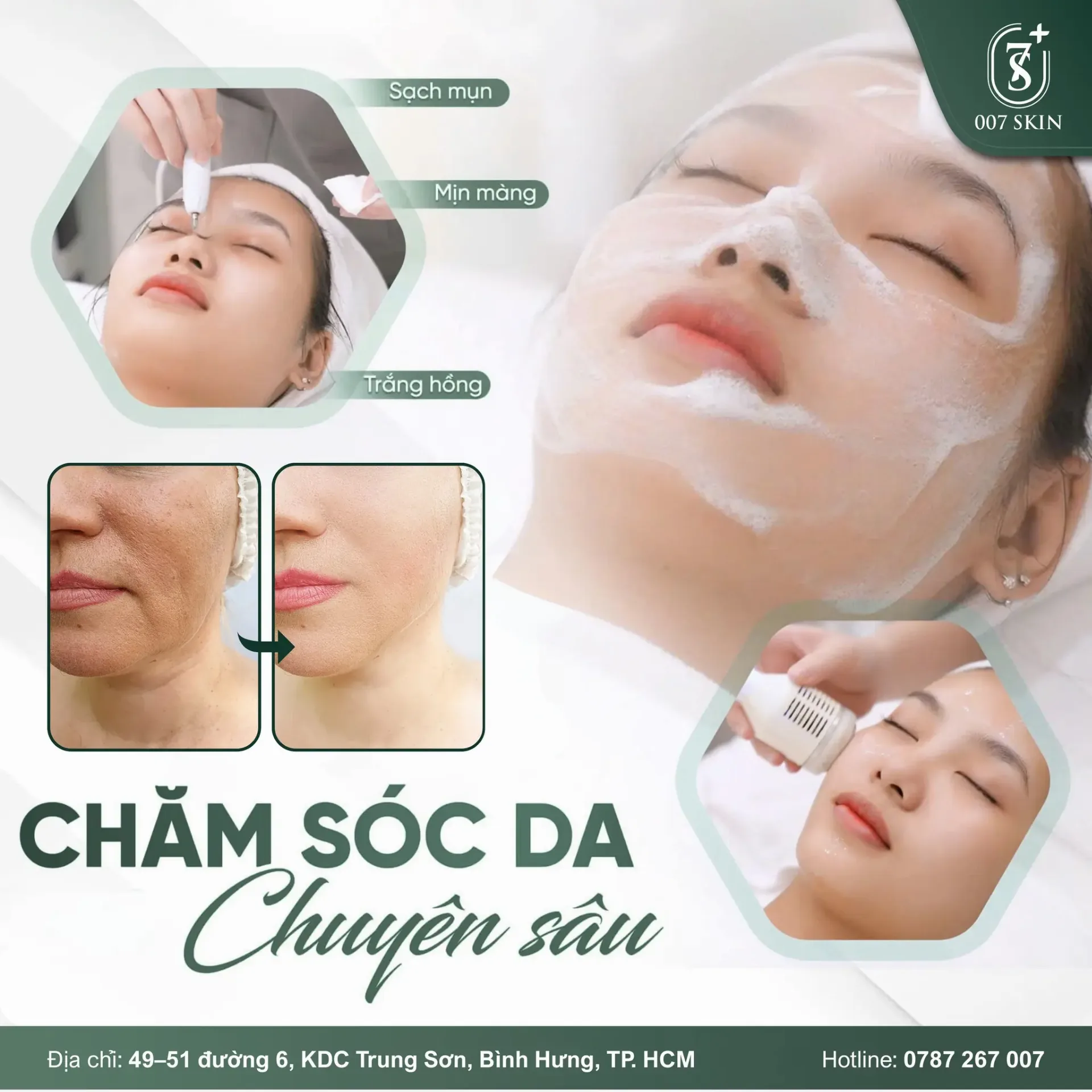 CHĂM SÓC DA CHUYÊN SÂU – ĐẸP TỪ GỐC, SÁNG TỪ TRONG