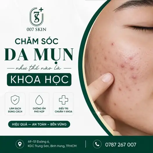 CHĂM SÓC DA MỤN THEO CÁCH CỦA CÁC CHUYÊN GIA - TỪ 007 SKIN! 🩺✨