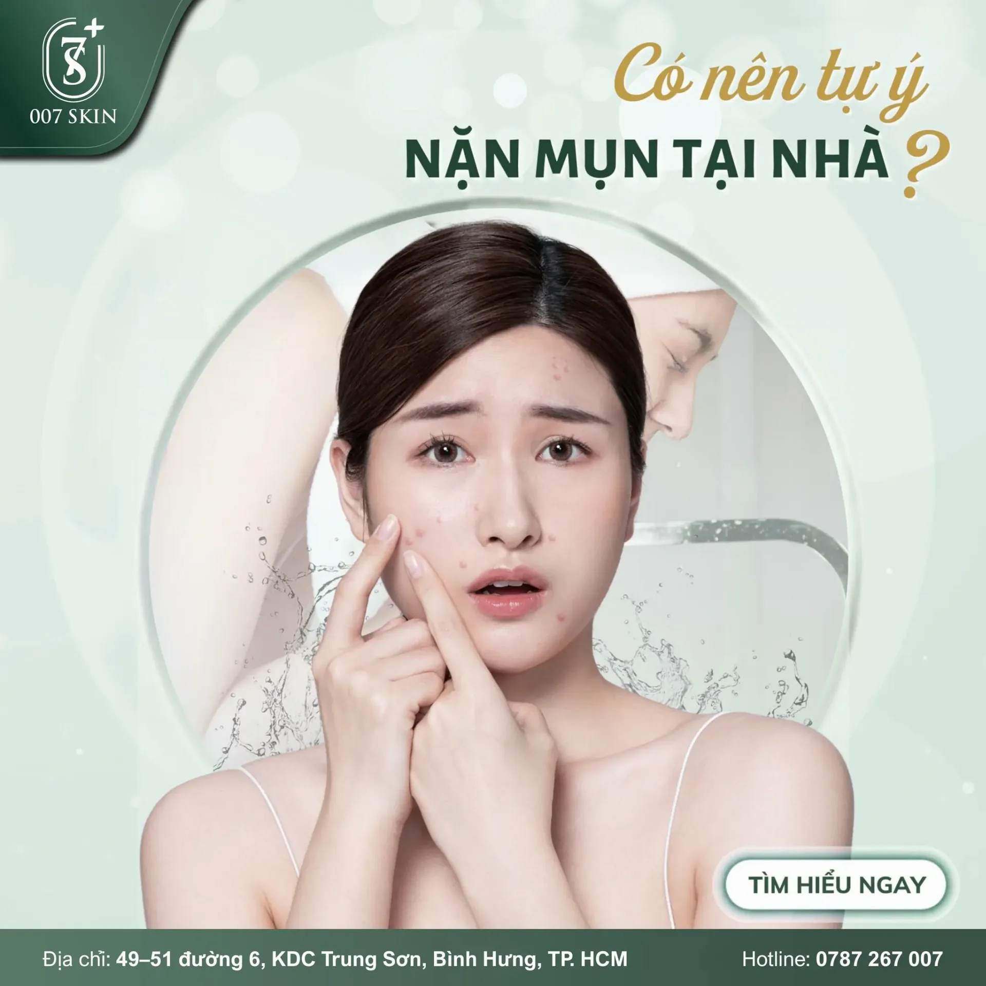 CÓ NÊN TỰ Ý NẶN MỤN TẠI NHÀ? – 007 SKIN
