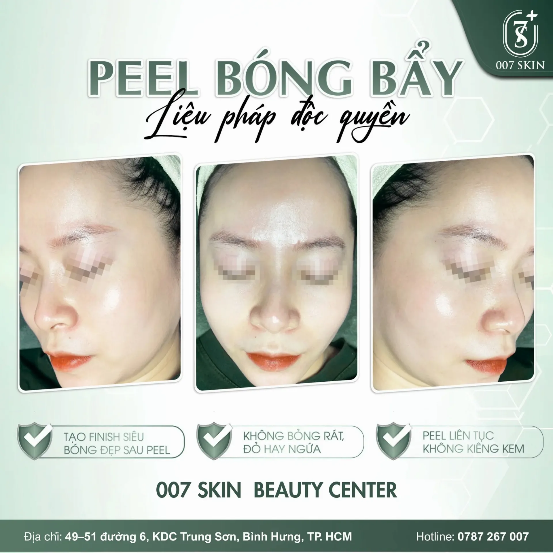 DA BÓNG BẨY HAY DA BÓNG DẦU? PHÂN BIỆT NGAY