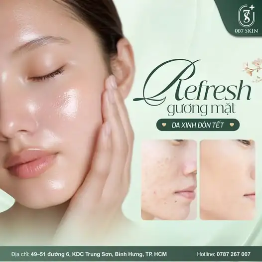 DA ĐẸP ĐÓN TẾT – TỰ TIN TỎA SÁNG CÙNG 007 SKIN!