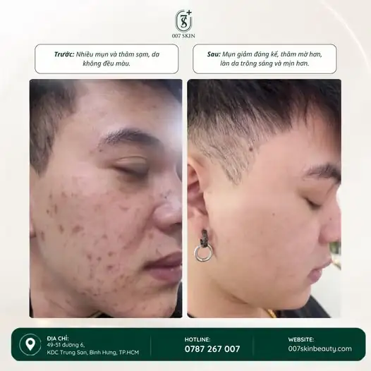 DA ĐẸP HƠN SAU HÀNH TRÌNH CHĂM SÓC ĐÚNG CÁCH!