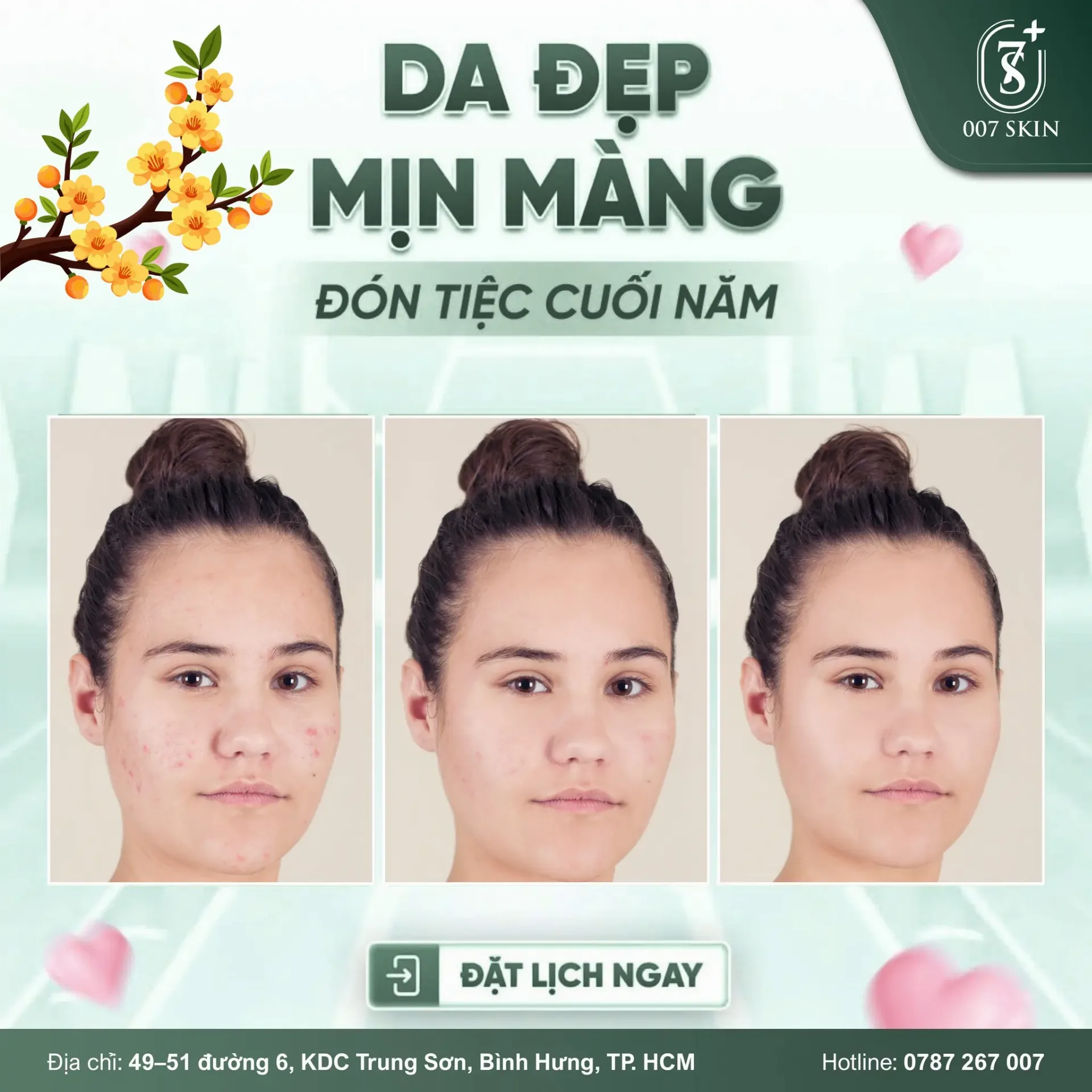 DA ĐẸP – MỊN MÀNG ĐÓN TIỆC CUỐI NĂM
