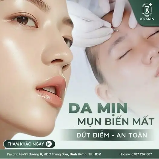 DA MỊN MÀNG - MỤN BIẾN MẤT: DỨT ĐIỂM & AN TOÀN 🌟