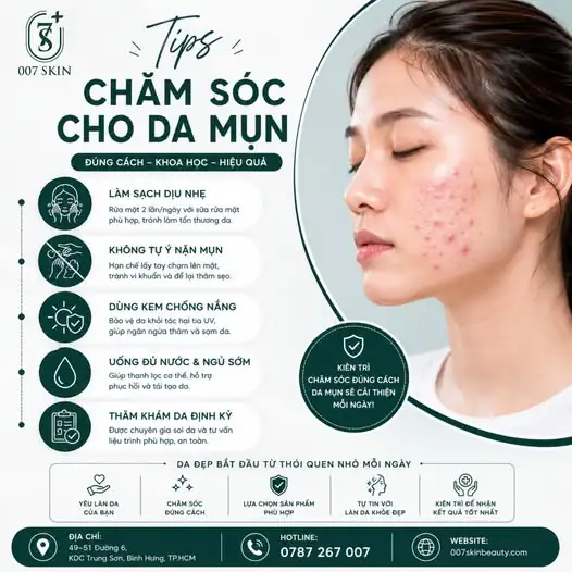 DA MỤN HOÀI KHÔNG HẾT – LIỆU BẠN ĐÃ CHĂM DA ĐÚNG CÁCH? ✨