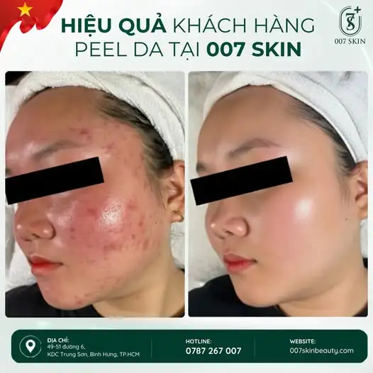 DA THAY ĐỔI – NHÌN THẤY RÕ QUA TỪNG KHUNG HÌNH!