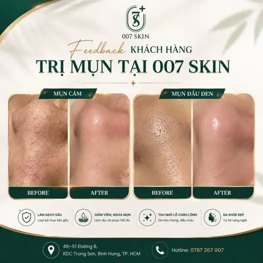 FEEDBACK KHÁCH HÀNG – KẾT QUẢ NÓI LÊN TẤT CẢ! ✨