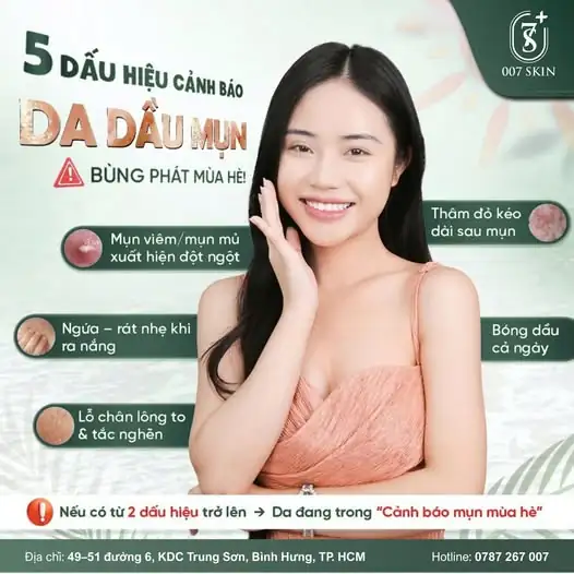 HÈ CHƯA ĐẾN NHƯNG MỤN ĐÃ “GÕ CỬA”? NHẬN BIẾT NGAY 5 DẤU HIỆU NÀY!