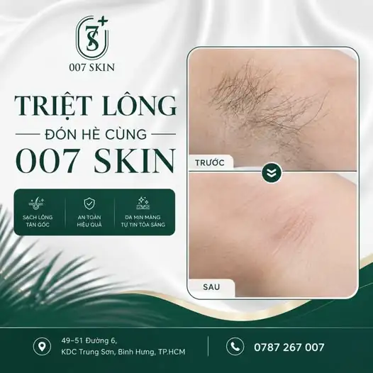 HÈ RỰC RỠ - DA MỊN MÀNG TỰ TIN TỎA SÁNG CÙNG 007 SKIN! ✨