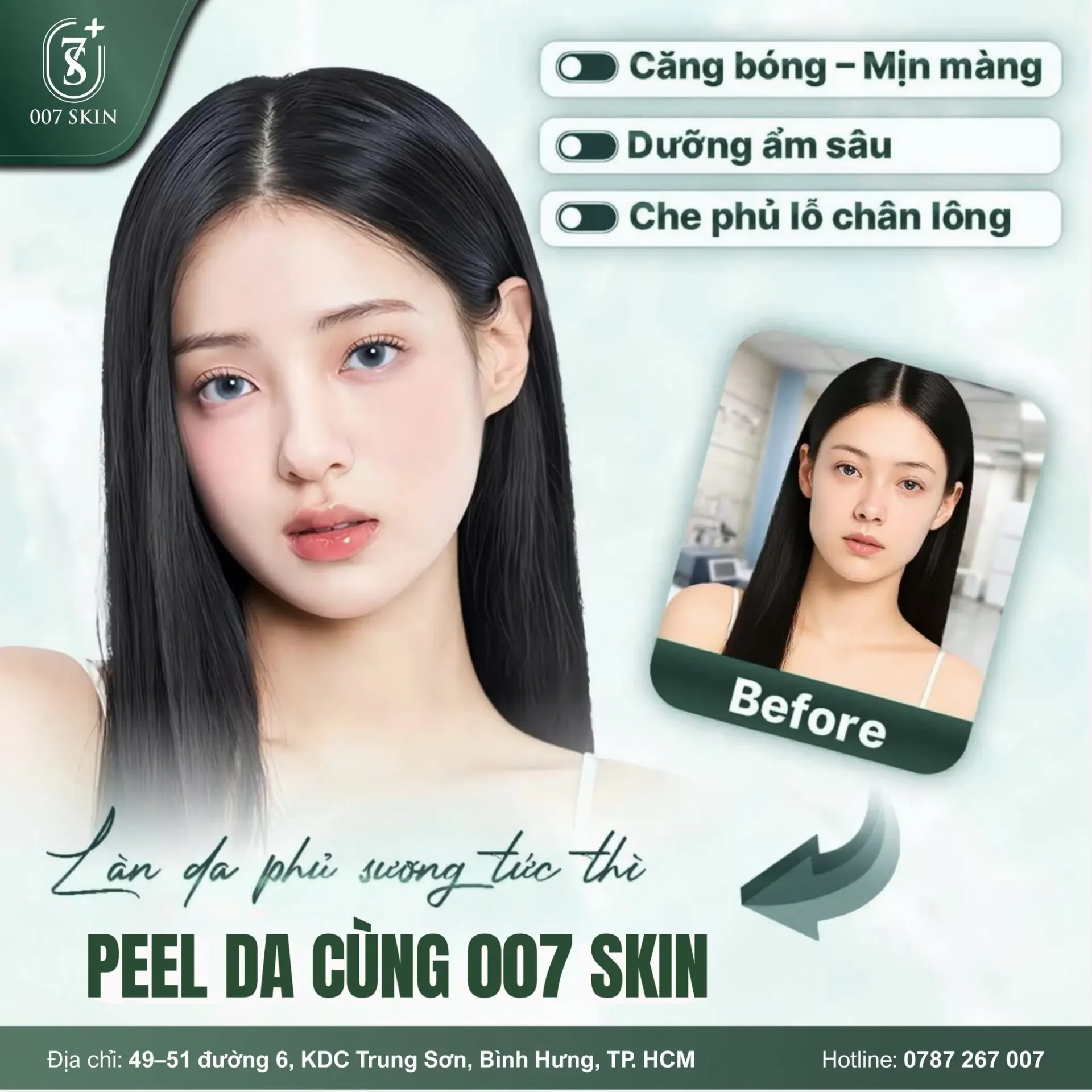 LÀN DA PHỦ SƯƠNG TỨC THÌ VỚI PEEL DA CÙNG 007 SKIN ✨