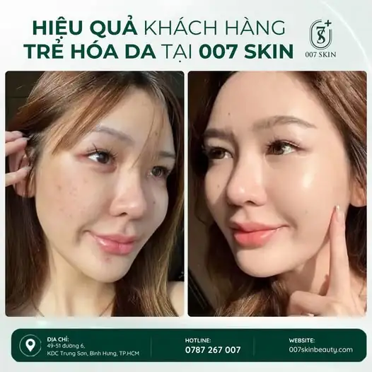 LÀN DA THAY ĐỔI – NHAN SẮC THĂNG HẠNG ✨
