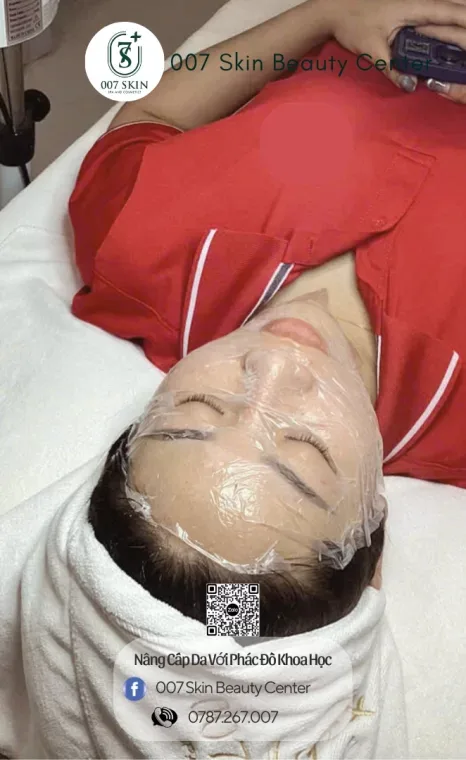 LAYERED PEEL - PEEL ĐA LỚP