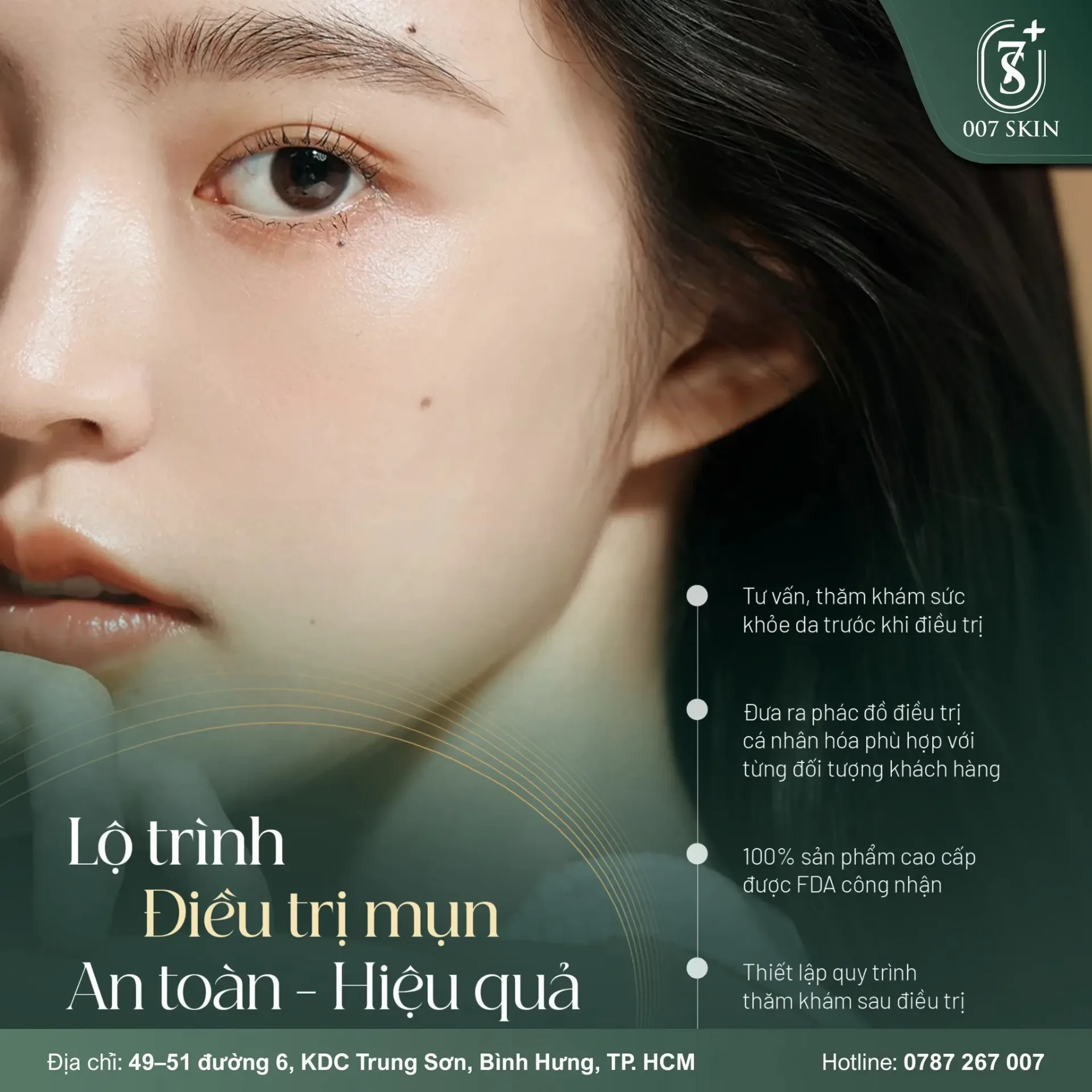 LỘ TRÌNH ĐIỀU TRỊ MỤN AN TOÀN & HIỆU QUẢ TẠI 007 SKIN: Tạm Biệt Mụn, Tự Tin Tỏa Sáng!