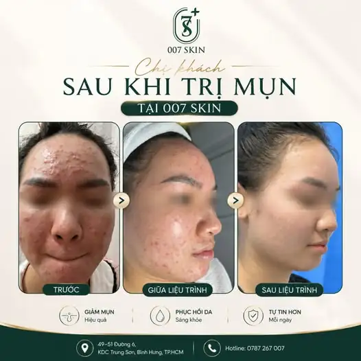 · ✨ Mỗi làn da đẹp đều bắt đầu từ một quyết định đúng!