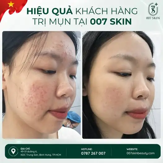 MỘT HÀNH TRÌNH – MỘT LÀN DA KHÁC BIỆT ✨