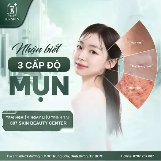 MỤN CẤP ĐỘ MẤY – 007 SKIN "XỬ ĐẸP" HẾT! 👊✨