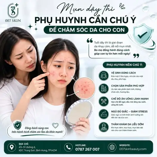 MỤN DẬY THÌ – BA MẸ CẦN CHÚ Ý ĐỂ ĐỒNG HÀNH CÙNG CON!