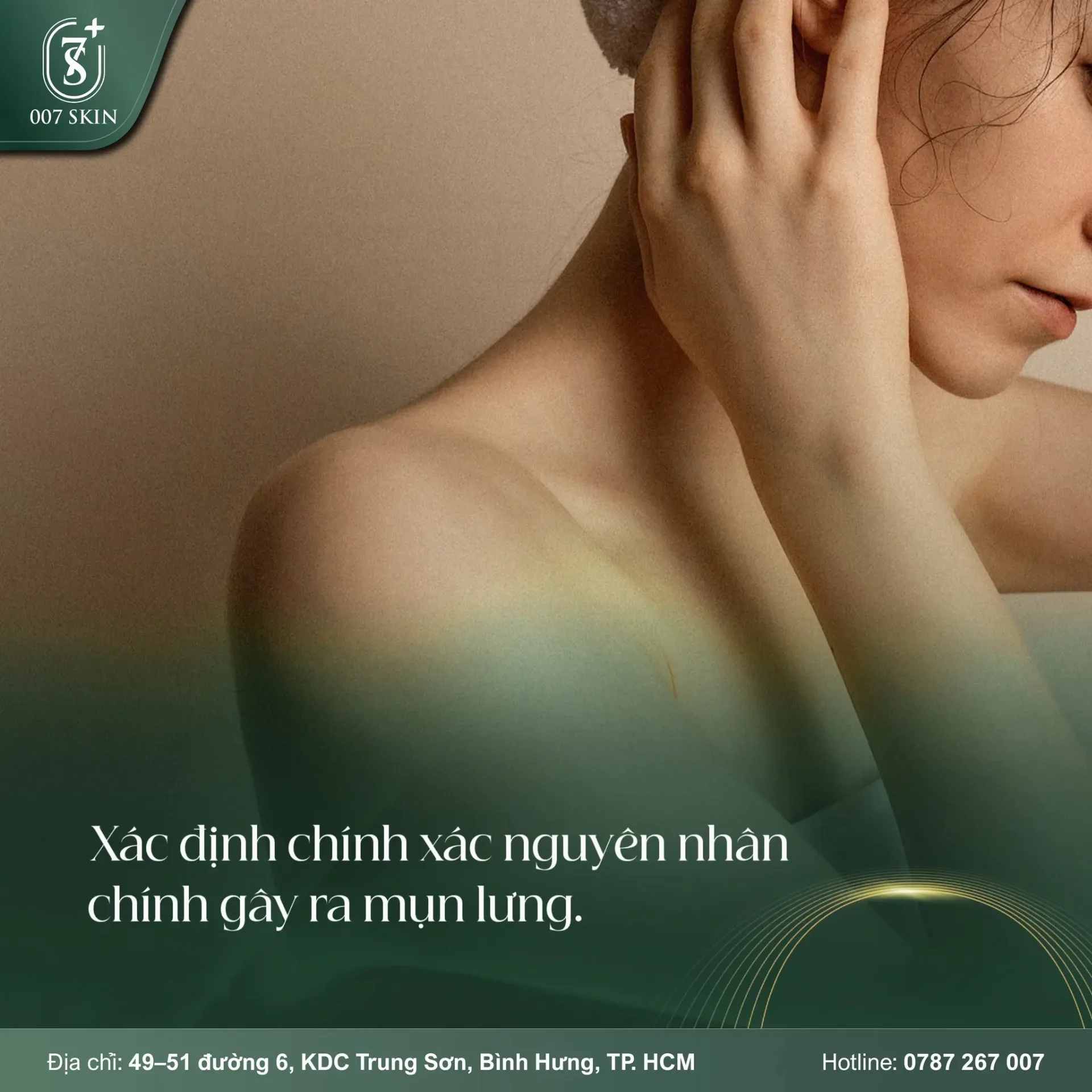 Mụn Lưng: Giải Mã Nguyên Nhân Gốc Rễ Để Chấm Dứt Nỗi Ám Ảnh