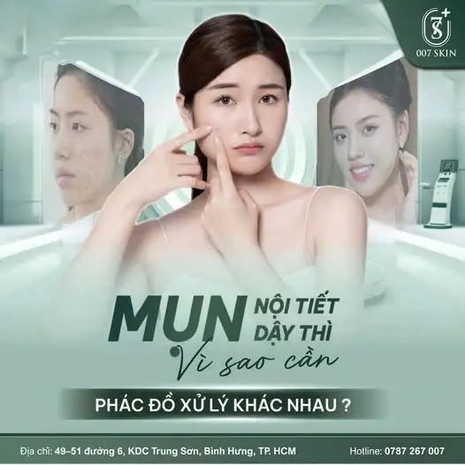 MỤN NỘI TIẾT & MỤN DẬY THÌ: TẠI SAO KHÔNG THỂ DÙNG CHUNG MỘT PHÁC ĐỒ?