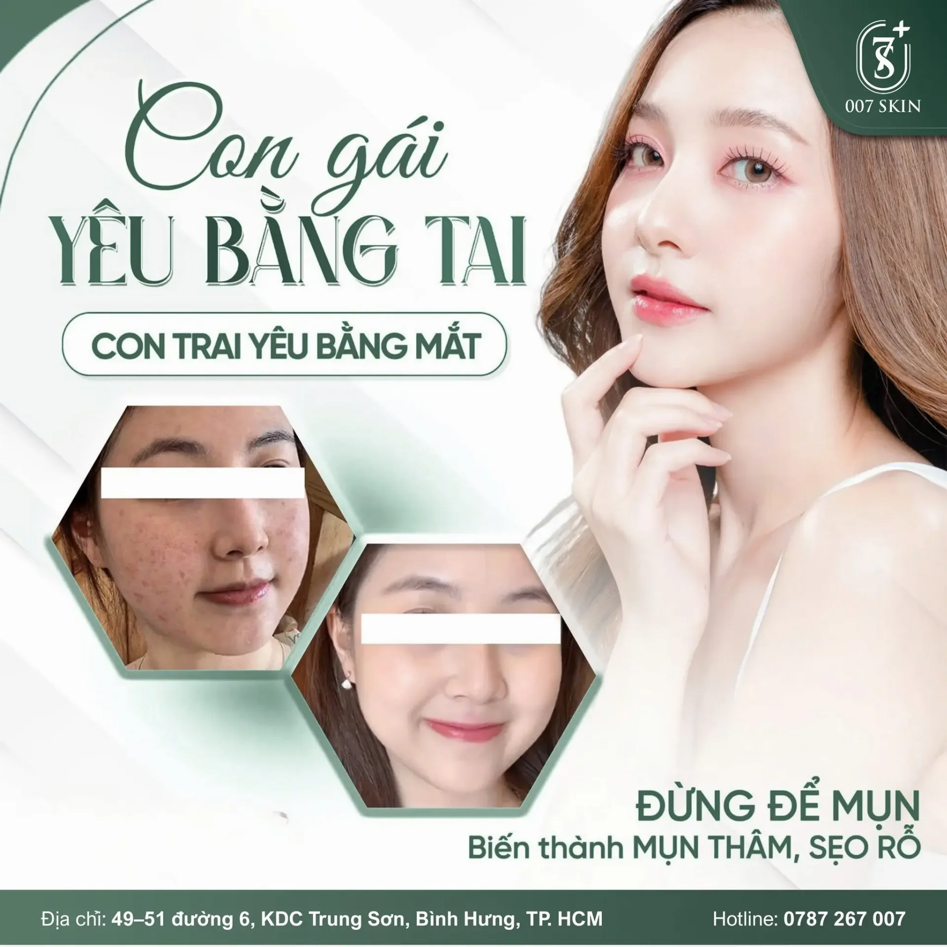 Mụn, Thâm & Sẹo Rỗ: Đừng Chần Chừ, Điều Trị Đúng Cách Ngay Hôm Nay!