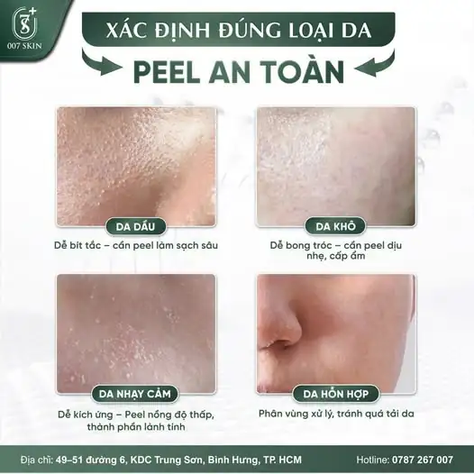 MUỐN PEEL DA ĐẸP - TRƯỚC HẾT PHẢI HIỂU LÀN DA! 🧪✨