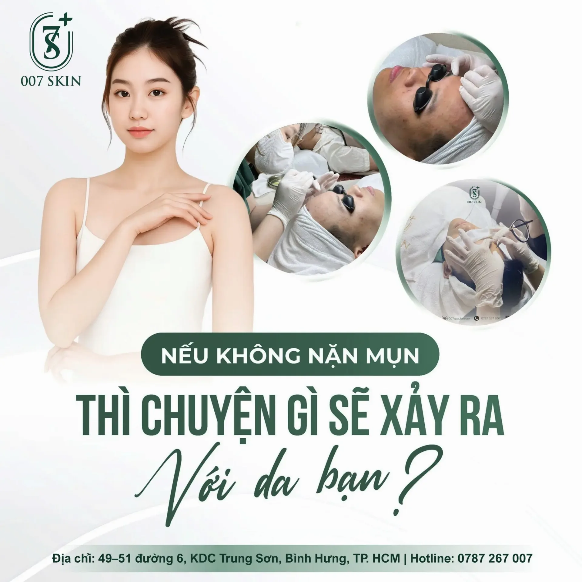 Nếu không nặn mụn – điều gì sẽ thật sự xảy ra với làn da bạn?