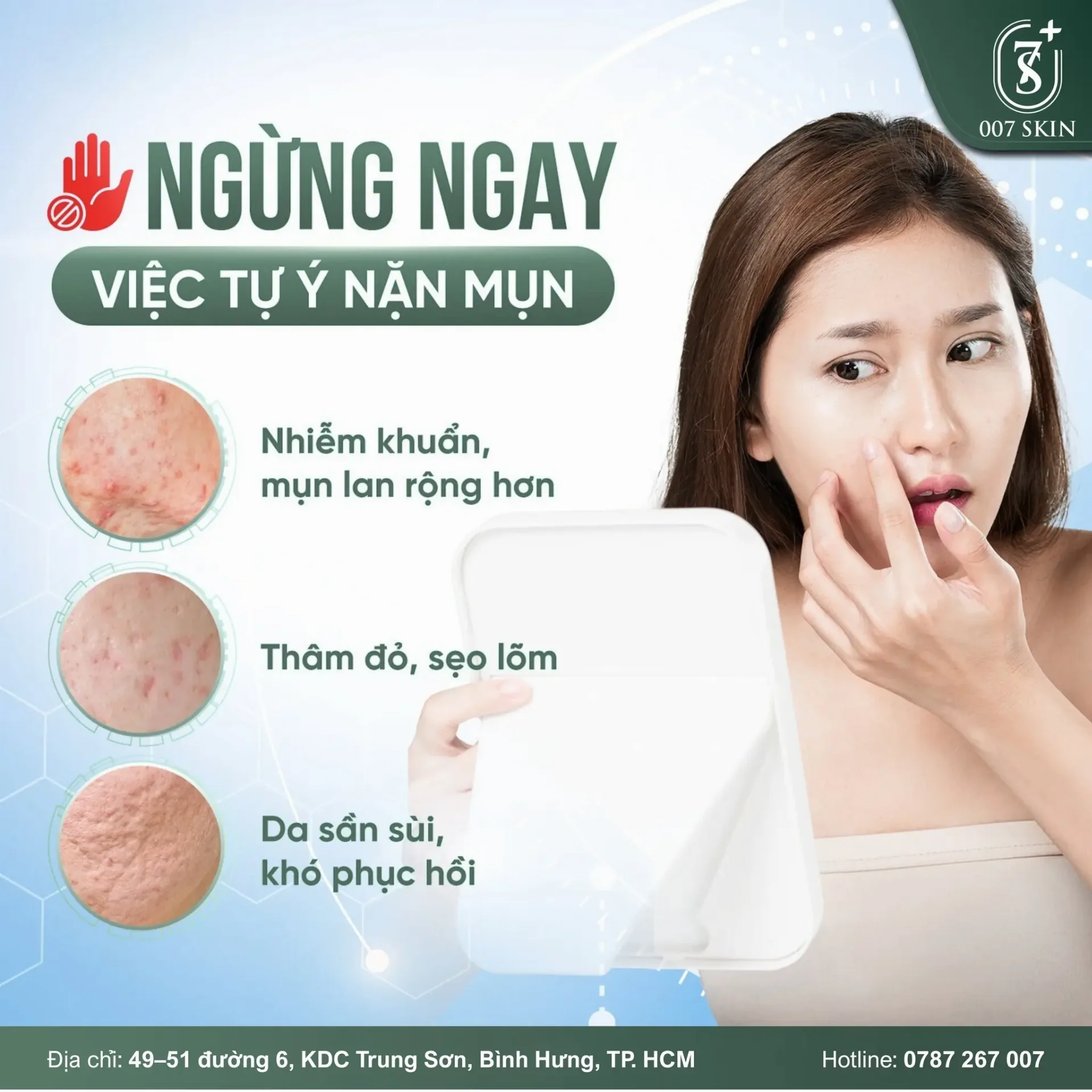 Ngừng ngay việc tự ý nặn mụn tại nhà!