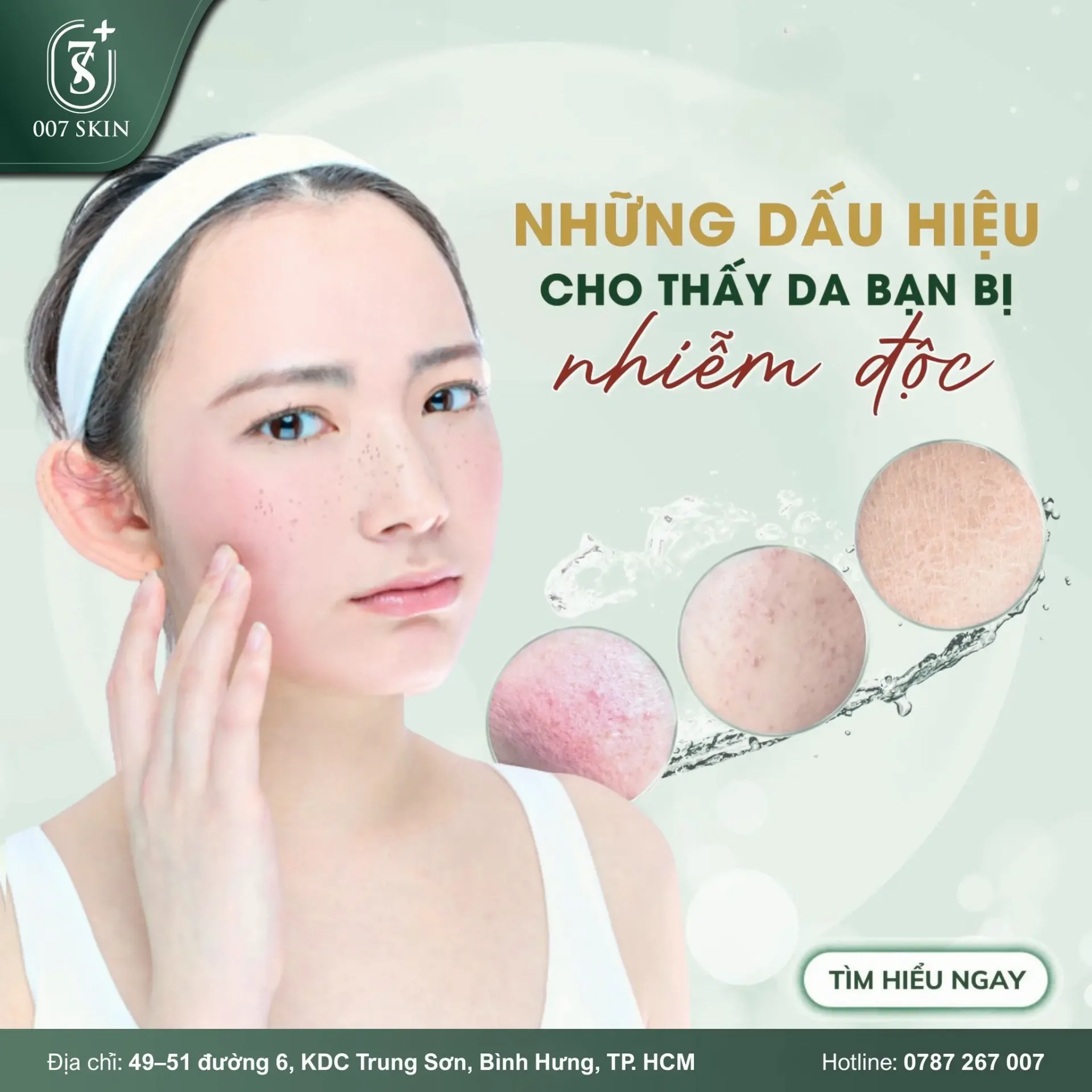 NHẬN BIẾT LÀN DA ĐANG “QUÁ TẢI” – 007 SKIN