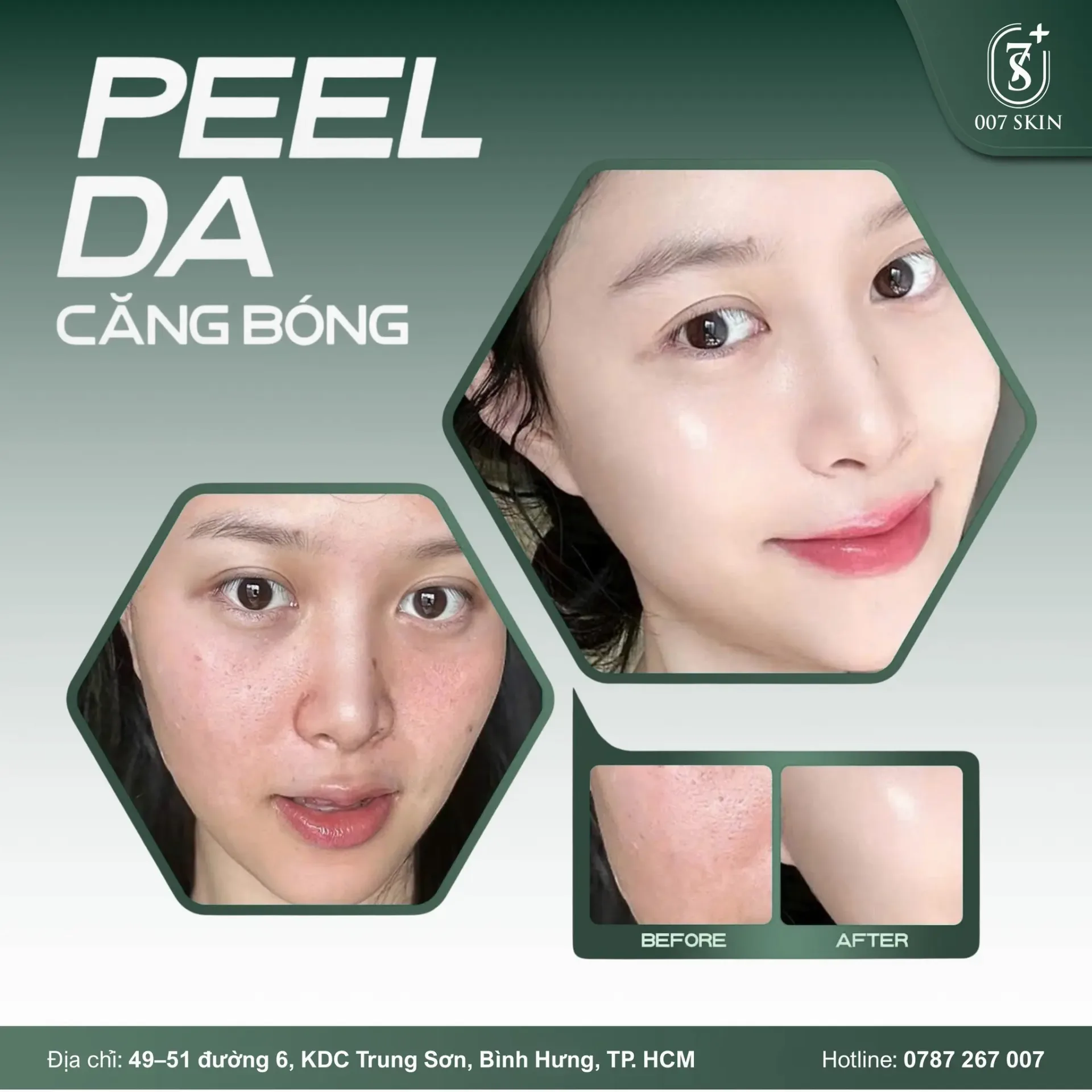 PEEL DA – BÍ QUYẾT LÀN DA CĂNG BÓNG, SÁNG MỊN TỰ NHIÊN