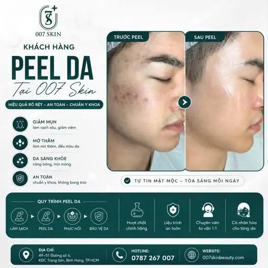 PEEL DA CHUẨN Y KHOA – GIẢI PHÁP VÀNG CHO LÀN DA KHOẺ ĐẸP 💯