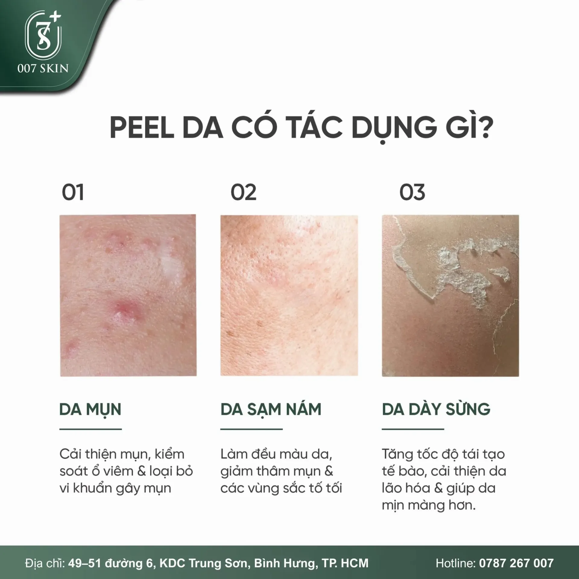 PEEL DA CÓ TÁC DỤNG GÌ?
