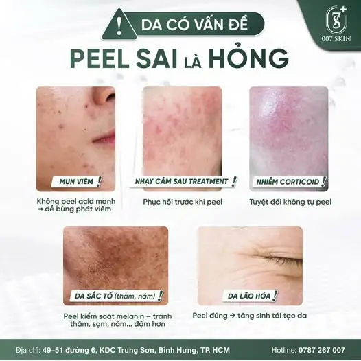 PEEL SAI MỘT LY – ĐI LUÔN LÀN DA! 🛑