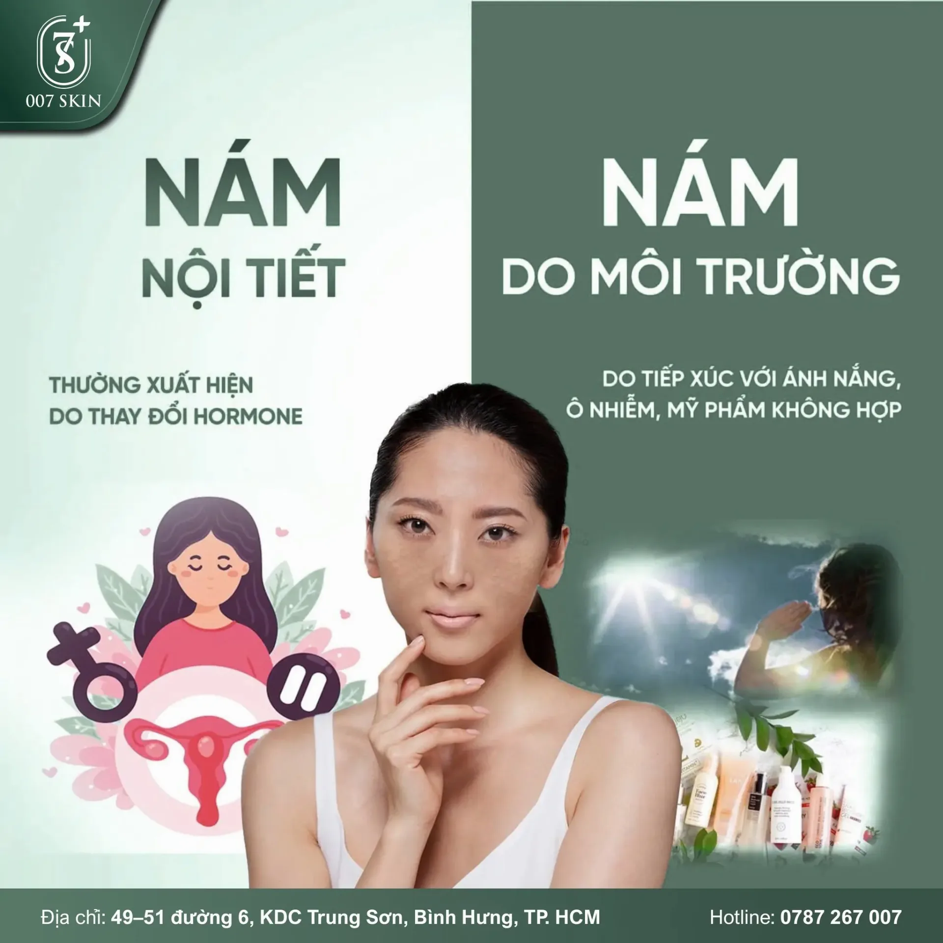 PHÂN BIỆT NÁM NỘI TIẾT & NÁM MÔI TRƯỜNG – HIỂU ĐÚNG ĐỂ TRỊ ĐÚNG!