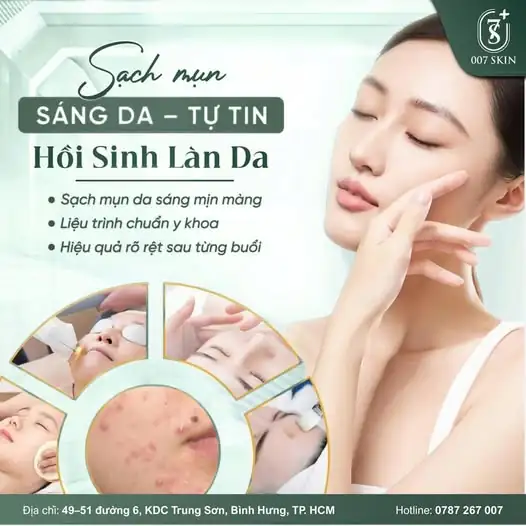 SẠCH MỤN - SÁNG DA - TỰ TIN TỎA SÁNG RẠNG NGỜI ! ✨