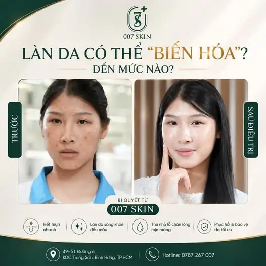 Sự thay đổi của làn da không đến sau một đêm, mà là kết quả của một liệu trình đúng và sự kiên trì.