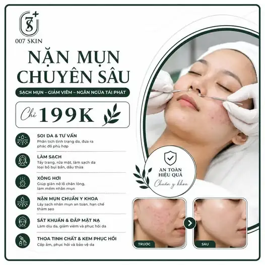 TẠI SAO NÊN CHỌN NẶN MỤN TẠI 007 SKIN?