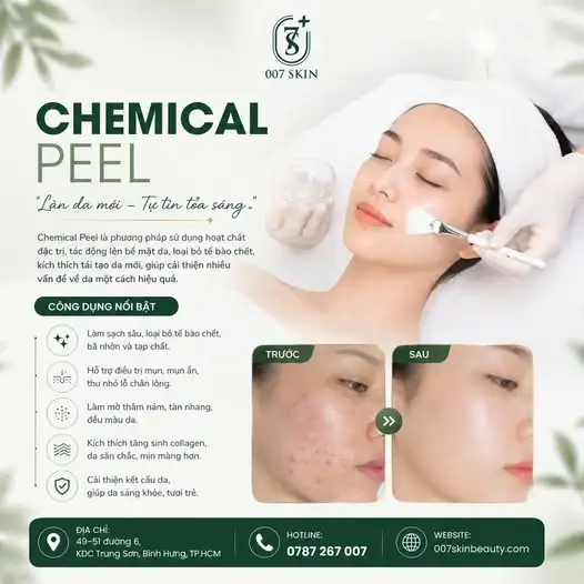 TẠM BIỆT DA MỤN THÂM – ĐÓN LÀN DA MỚI RẠNG RỠ ✨