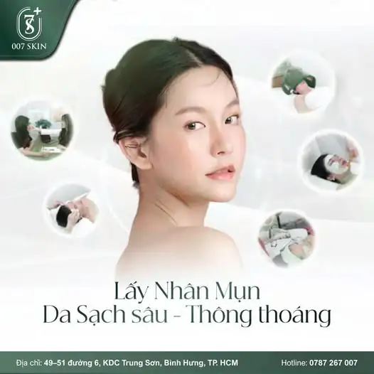 TẠM BIỆT MỤN - LÀN DA SẠCH SÂU, THÔNG THOÁNG TỨC THÌ ✨