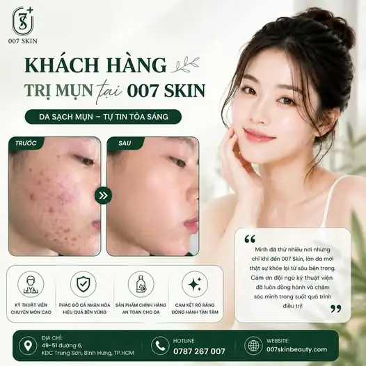 TẠM BIỆT MỤN VIÊM – ĐÓN DIỆN MẠO MỚI TỰ TIN TỎA SÁNG! ✨