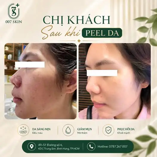 Thay đổi nhỏ – Khác biệt lớn!