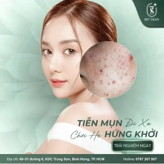 TIỄN MỤN "BAY MÀU" - SẴN SÀNG QUẨY HÈ RỰC RỠ! ☀️👙