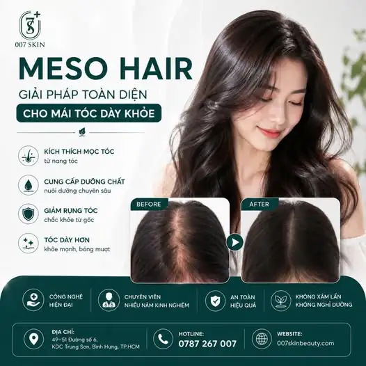 TÓC MỎNG, DỄ GÃY RỤNG? ĐỪNG CHỈ NHÌN MÀ HÃY HÀNH ĐỘNG! 💆‍♀️