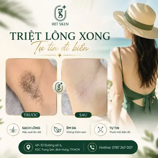 Triệt lông xong – Tự tin diện bikini, tận hưởng mùa hè trọn vẹn!