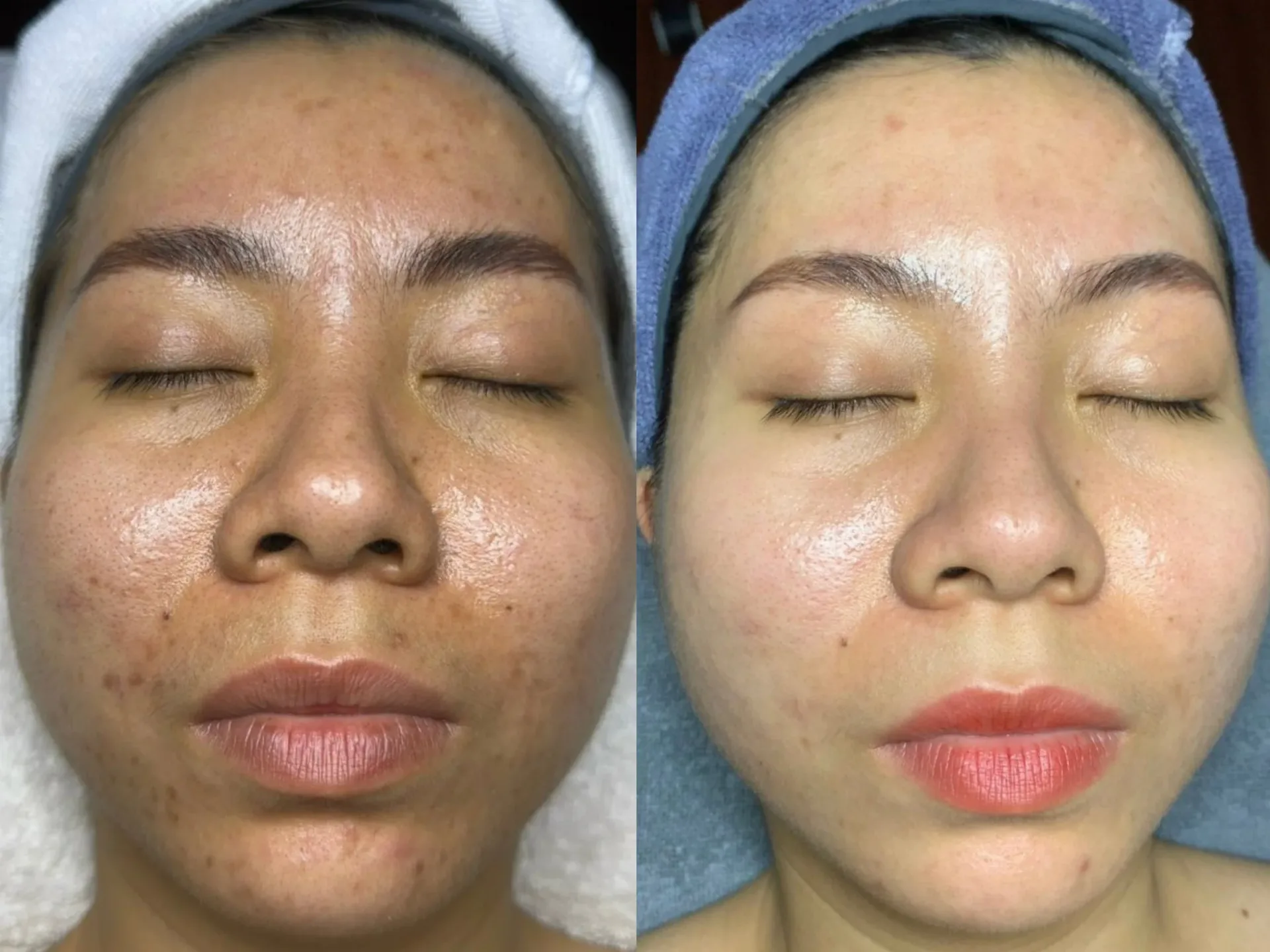 Tuyệt Vọng! Da Càng Chăm Càng Sạm: Tìm Lại Làn Da Rạng Rỡ