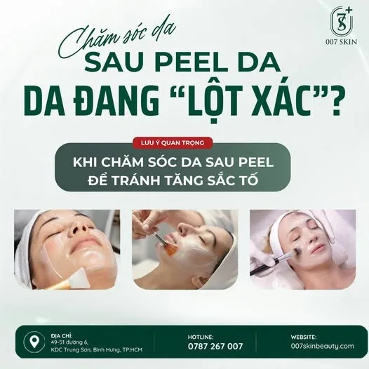 ✨ SAU PEEL DA – ĐỪNG CHỦ QUAN VỚI VIỆC CHĂM SÓC!